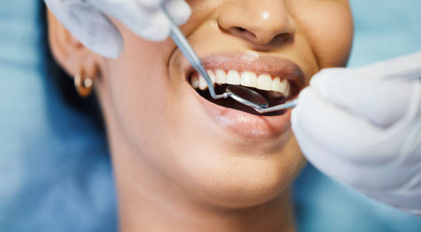 Best Emergency Root Canal Treatment in Huntsville, TN